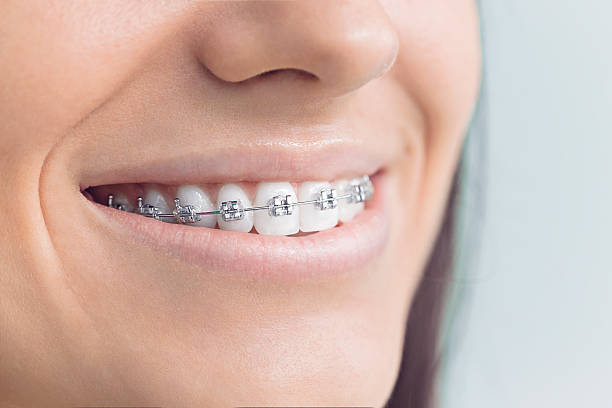 Dental Inlays and Onlays in South Elgin, IL